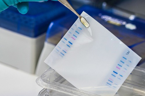Western blot 蛋白免疫印迹